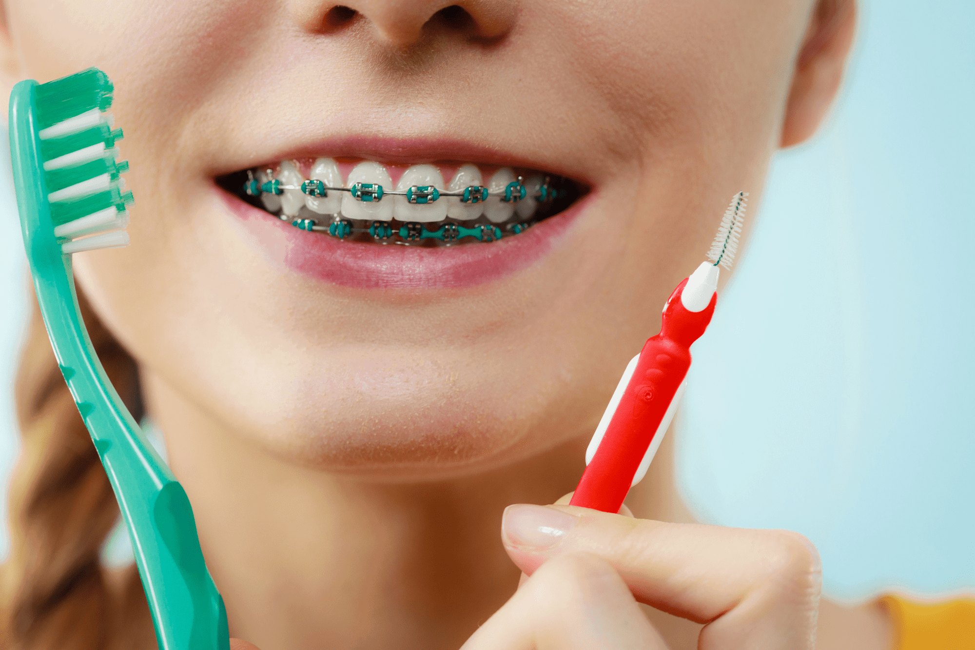 Гигиена полости рта с брекетами в кабинете стоматолога