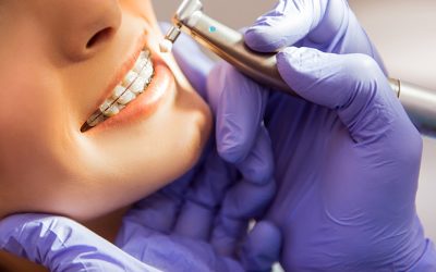 L’importance d’un traitement orthodontique