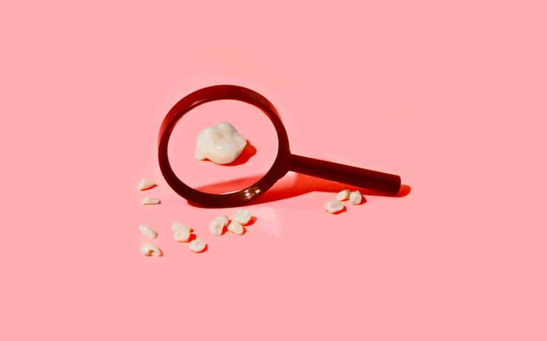 Dent cassée : solutions, réparation, que faire ?