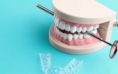 Comment soigner le bruxisme ?