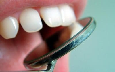 Comment savoir si l’on a une carie ?