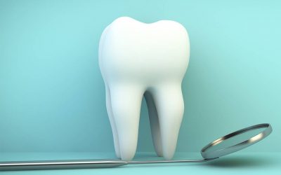 D’où viennent les dents transparentes ? Quels traitements ?