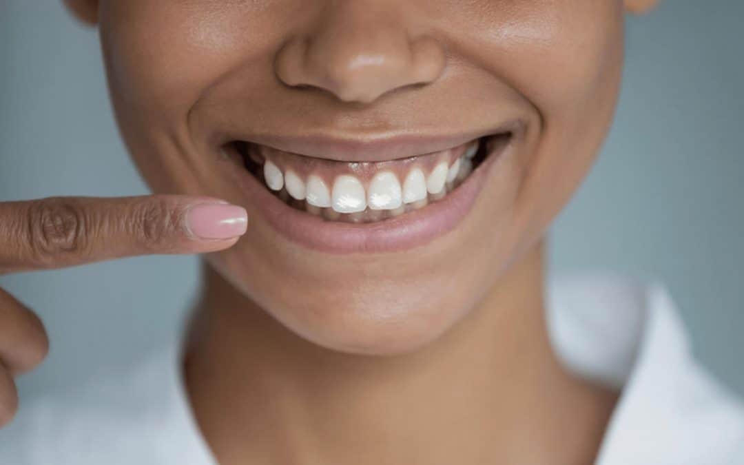 Fluorose : quel traitement ?