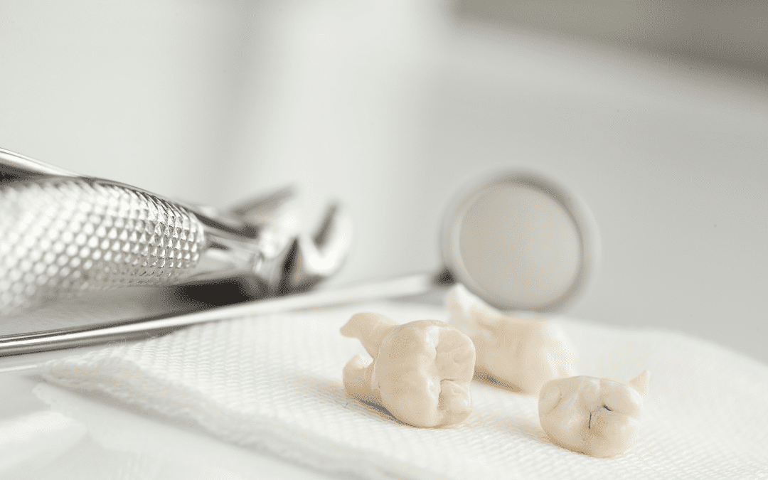 Pourquoi enlever les dents de sagesse ?