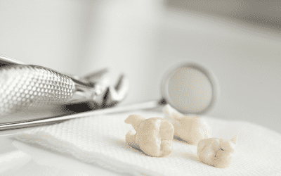 Pourquoi enlever les dents de sagesse ?