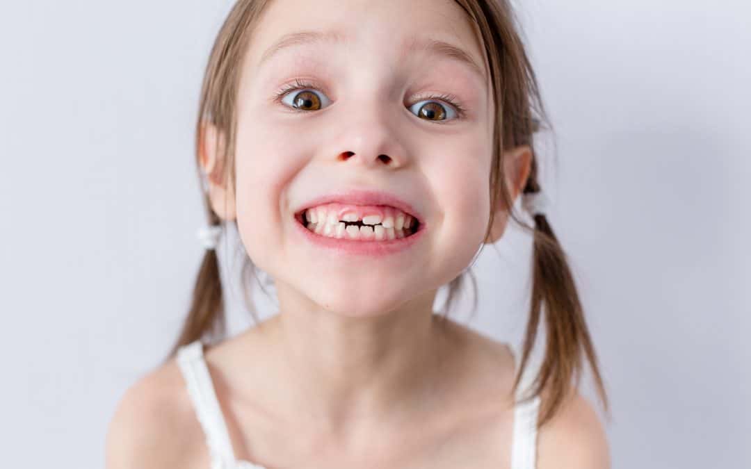 Dents d’enfant : quel est le développement ?