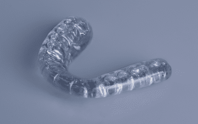 Gouttière Occlusale : qu’est-ce que c’est et pourquoi l’utiliser ?