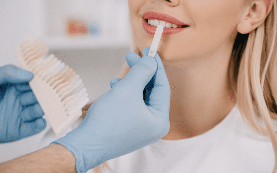 Quelle est la couleur naturelle d’une dent ? Est-elle blanche ?