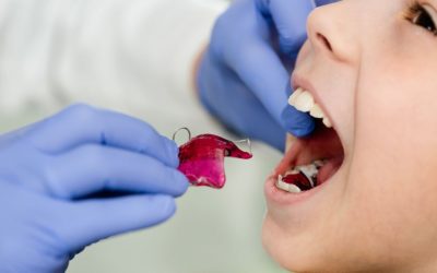 Comment manger après la pose d’un appareil dentaire au palais ?