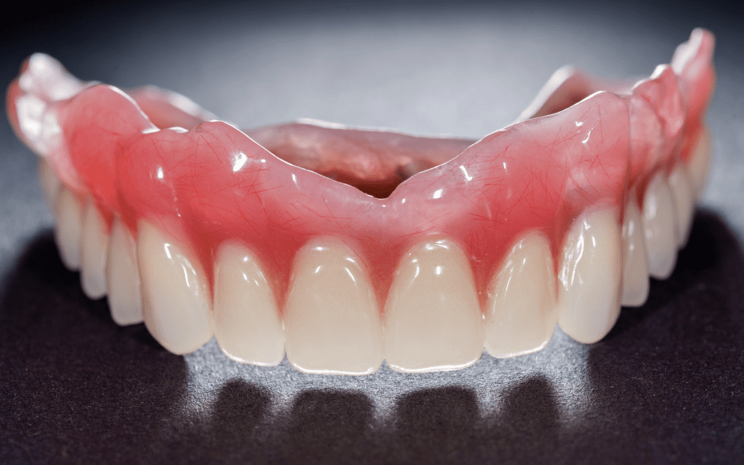 Quand changer son dentier ?