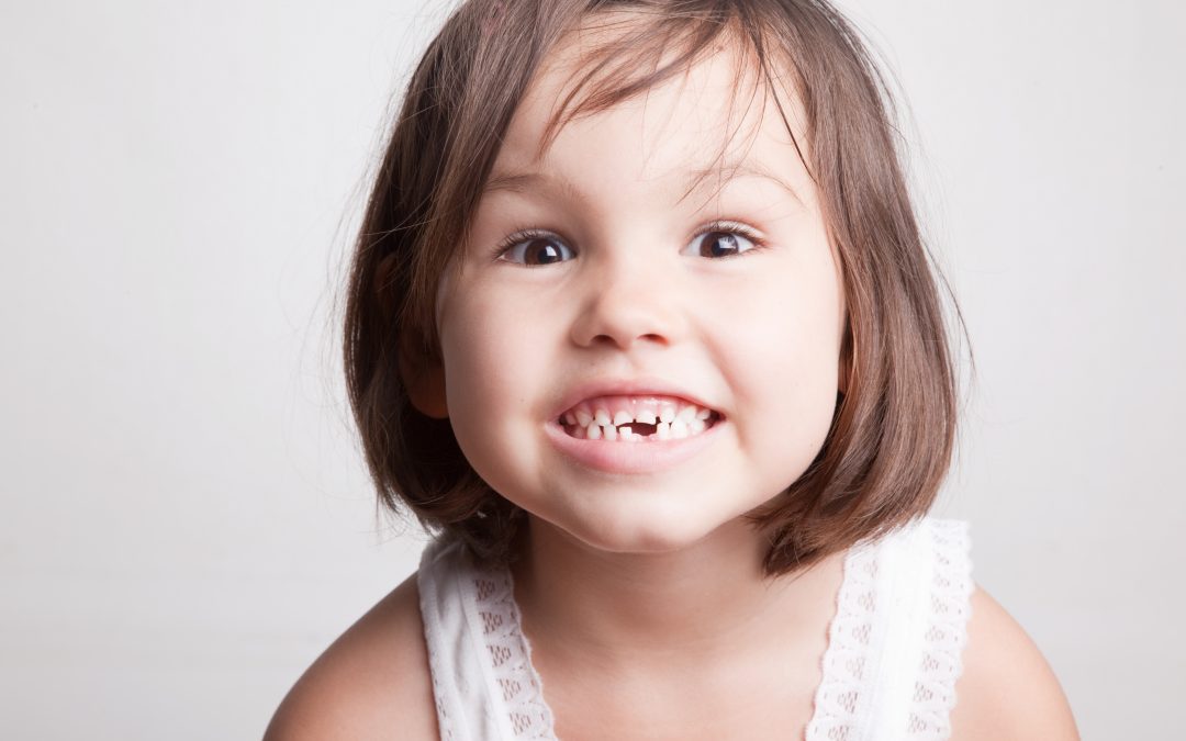 Quelles solutions de prothèse pédiatrique sur dent de lait ?