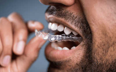 Pourquoi et comment porter un appareil dentaire la nuit ?