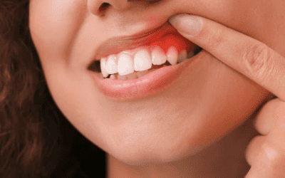 Problèmes parodontaux : quelles sont les maladies ?