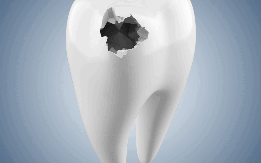 Comment enlever un tout petit point noir sur une dent ?