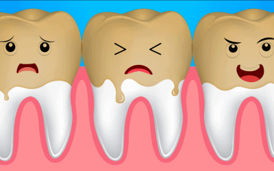 D’où viennent les taches marron sur les dents ?