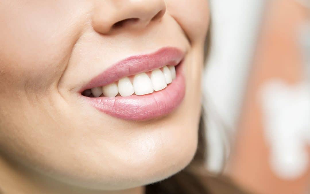 Blanchiment dentaire maison : quels sont les risques ?