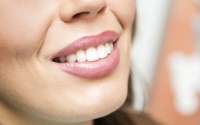 Blanchiment dentaire maison : quels sont les risques ?