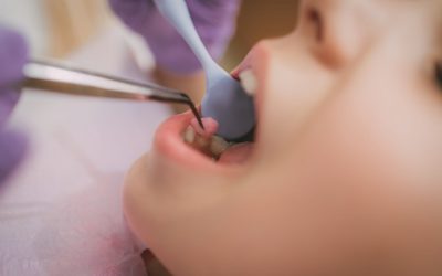 Complémentaire dentaire : comment faire son choix ?
