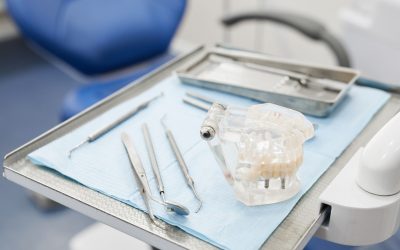 Prothèses dentaires fixes : pourquoi faire ce choix ?