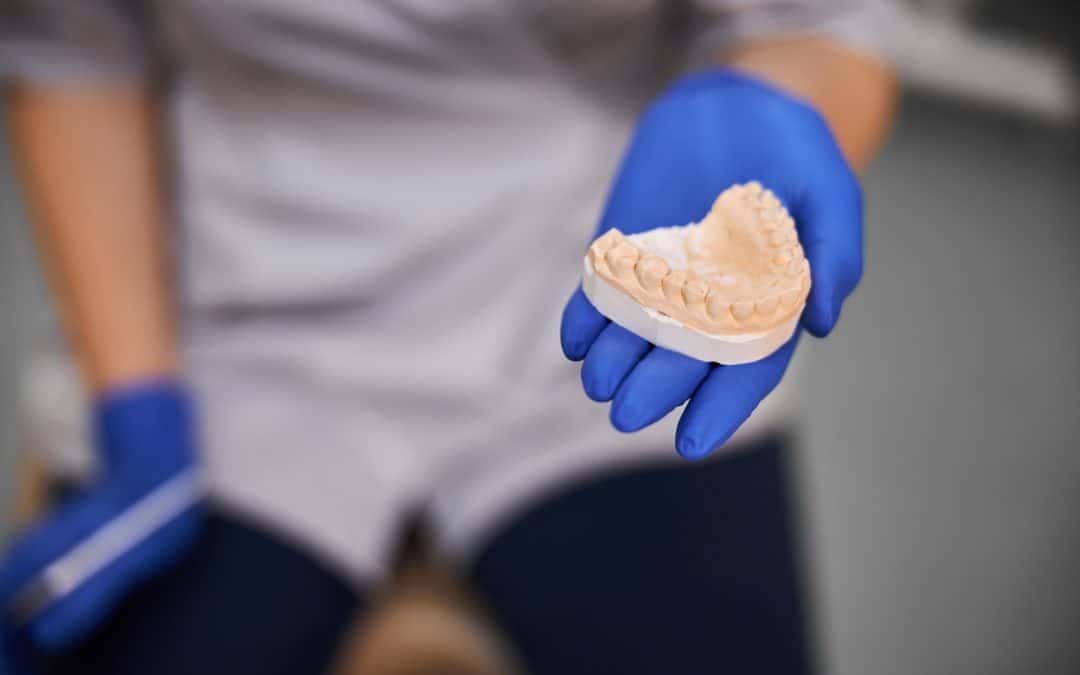 Prothésiste dentaire : quel est son rôle ?