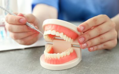 Implant dentaire en zircone : avantages et inconvénients